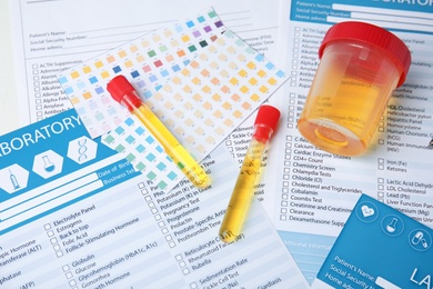Photo of Laboratory ware with urine samples for analysis on test form, above view
