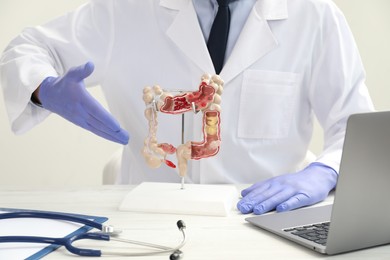 Photo of Doctor showing model of large intestine at white table, closeup