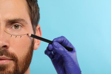 Image of Man preparing for cosmetic surgery, light blue background. Doctor drawing markings on his face, closeup