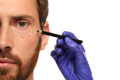 Doctor with pencil preparing patient for cosmetic surgery operation on white background, closeup