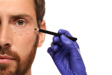 Photo of Doctor with pencil preparing patient for cosmetic surgery operation on white background, closeup