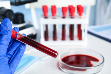 Photo of Scientist holding test tube with blood sample at table, closeup. Virus research