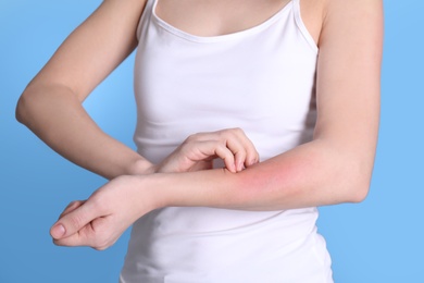 Photo of Woman with allergy symptoms scratching forearm on color background, closeup