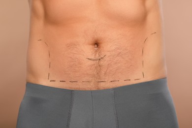Photo of Man with markings on belly before cosmetic surgery operation on light brown background, closeup