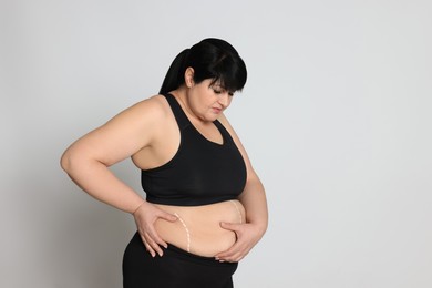 Photo of Obese woman with marks on body against light background, space for text. Weight loss surgery