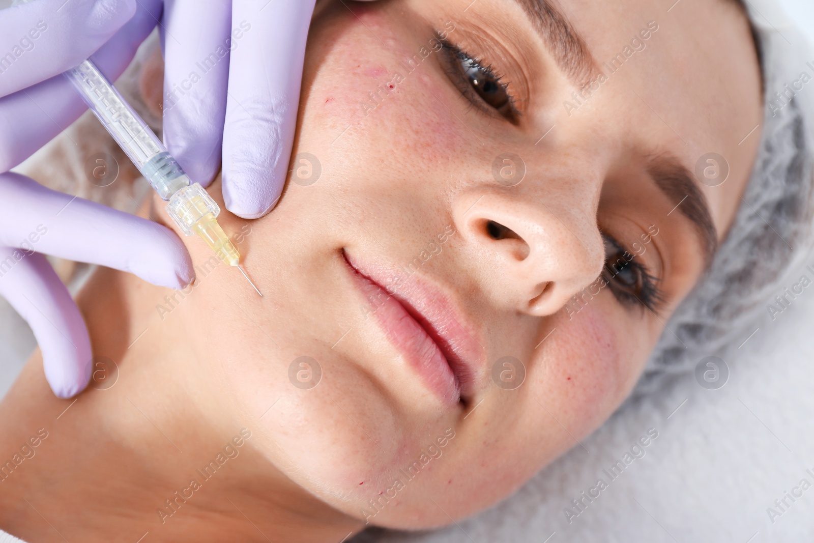 Photo of Woman undergoing face biorevitalization procedure in salon, closeup. Cosmetic treatment