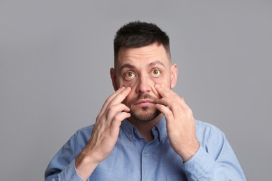 Photo of Man checking his health condition on grey background. Yellow eyes as symptom of problems with liver