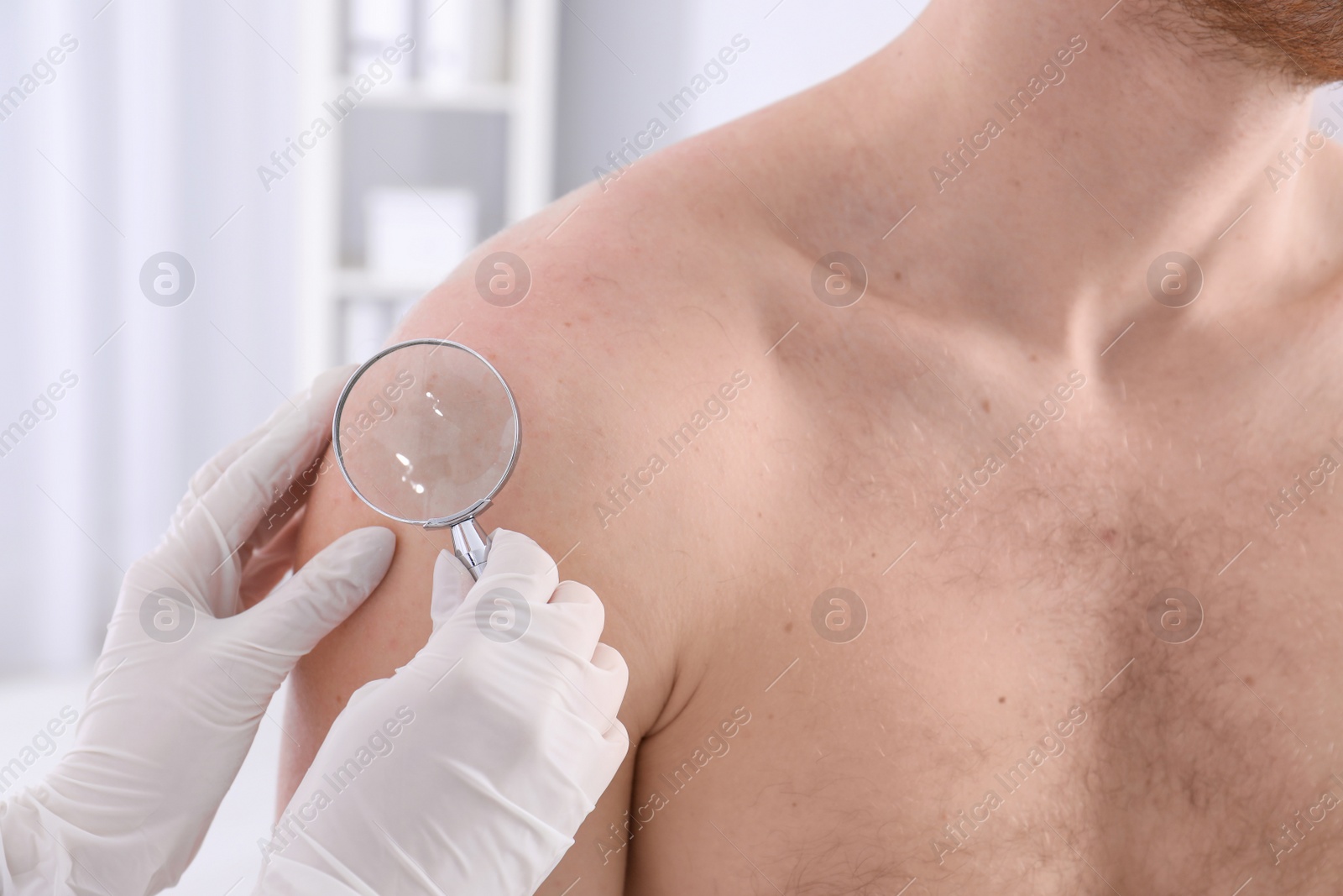 Photo of Dermatologist examining patient with magnifying glass in clinic, closeup view