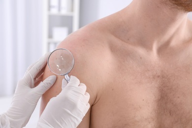 Photo of Dermatologist examining patient with magnifying glass in clinic, closeup view