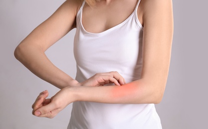Photo of Woman with allergy symptoms scratching forearm on grey background, closeup