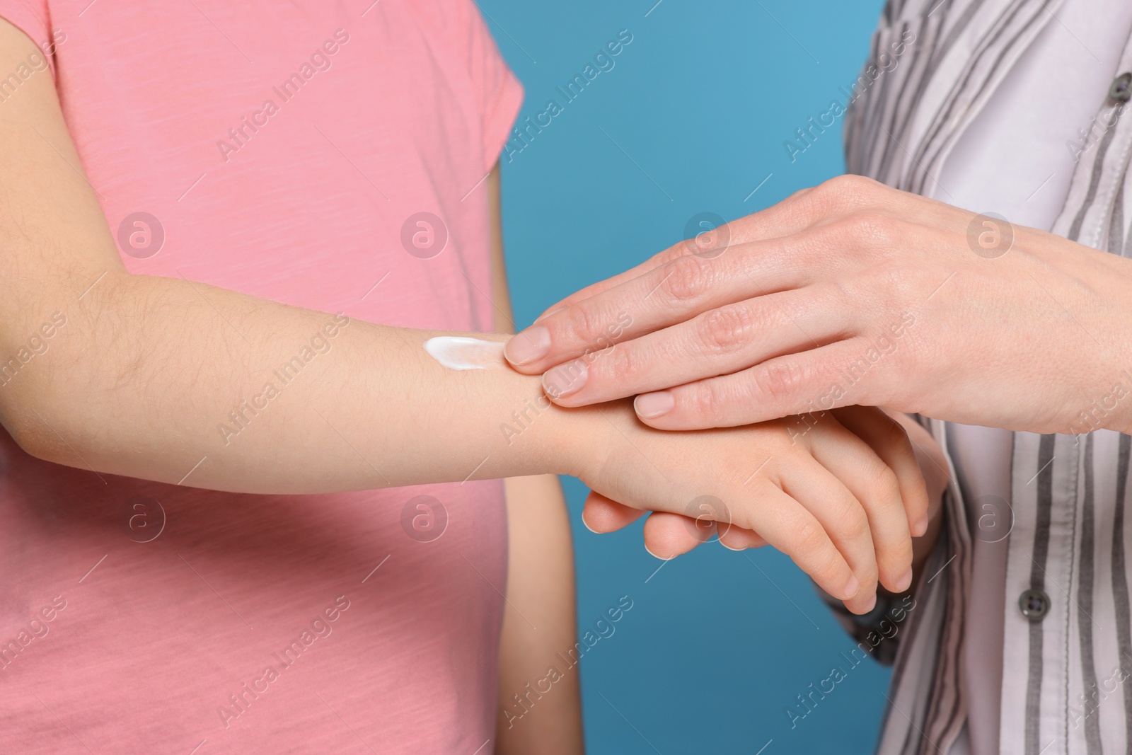 Photo of Mother applying ointment onto her daughter's arm on light blue background, closeup