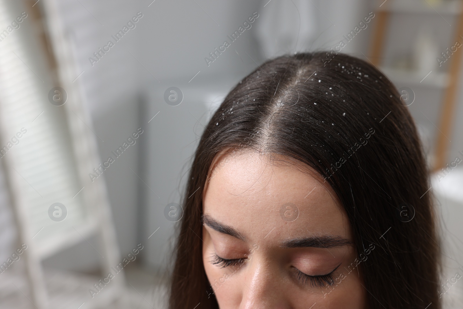 Photo of Woman with dandruff problem indoors, closeup. Space for text