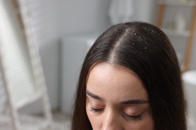 Photo of Woman with dandruff problem indoors, closeup. Space for text
