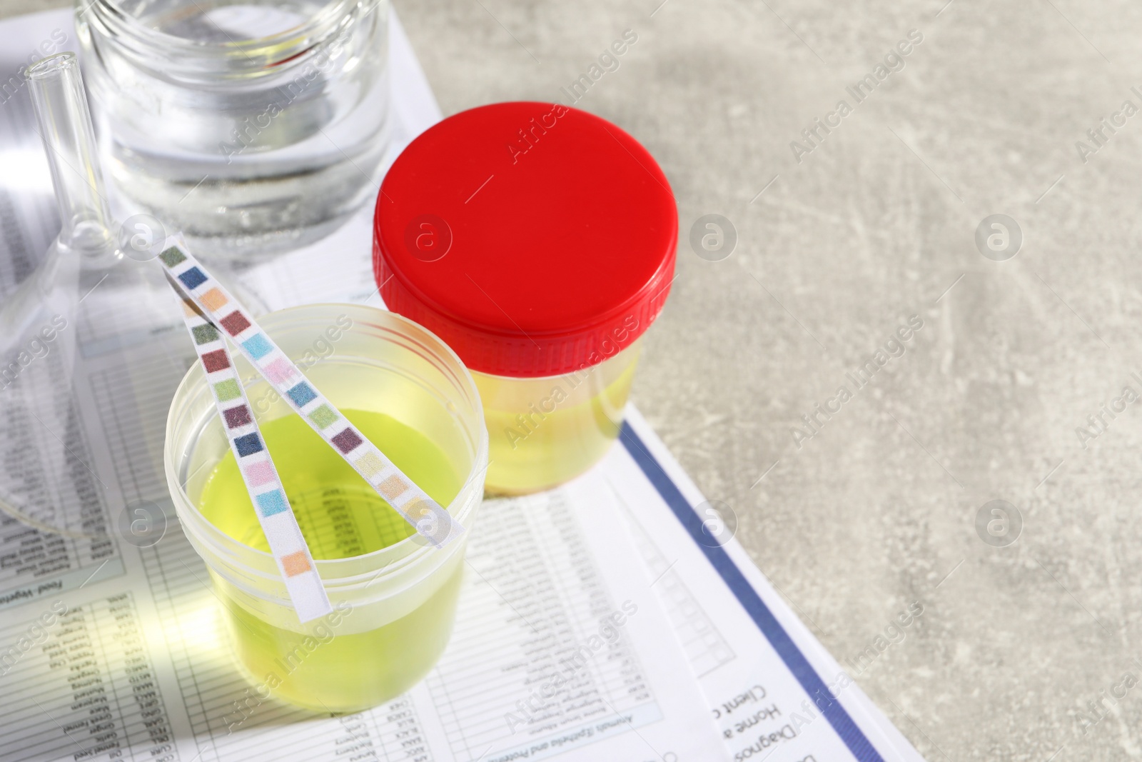 Photo of Containers with urine samples for analysis, glassware and test forms on grey table, above view. Space for text