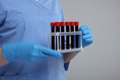 Laboratory testing. Doctor with blood samples in tubes on light grey background