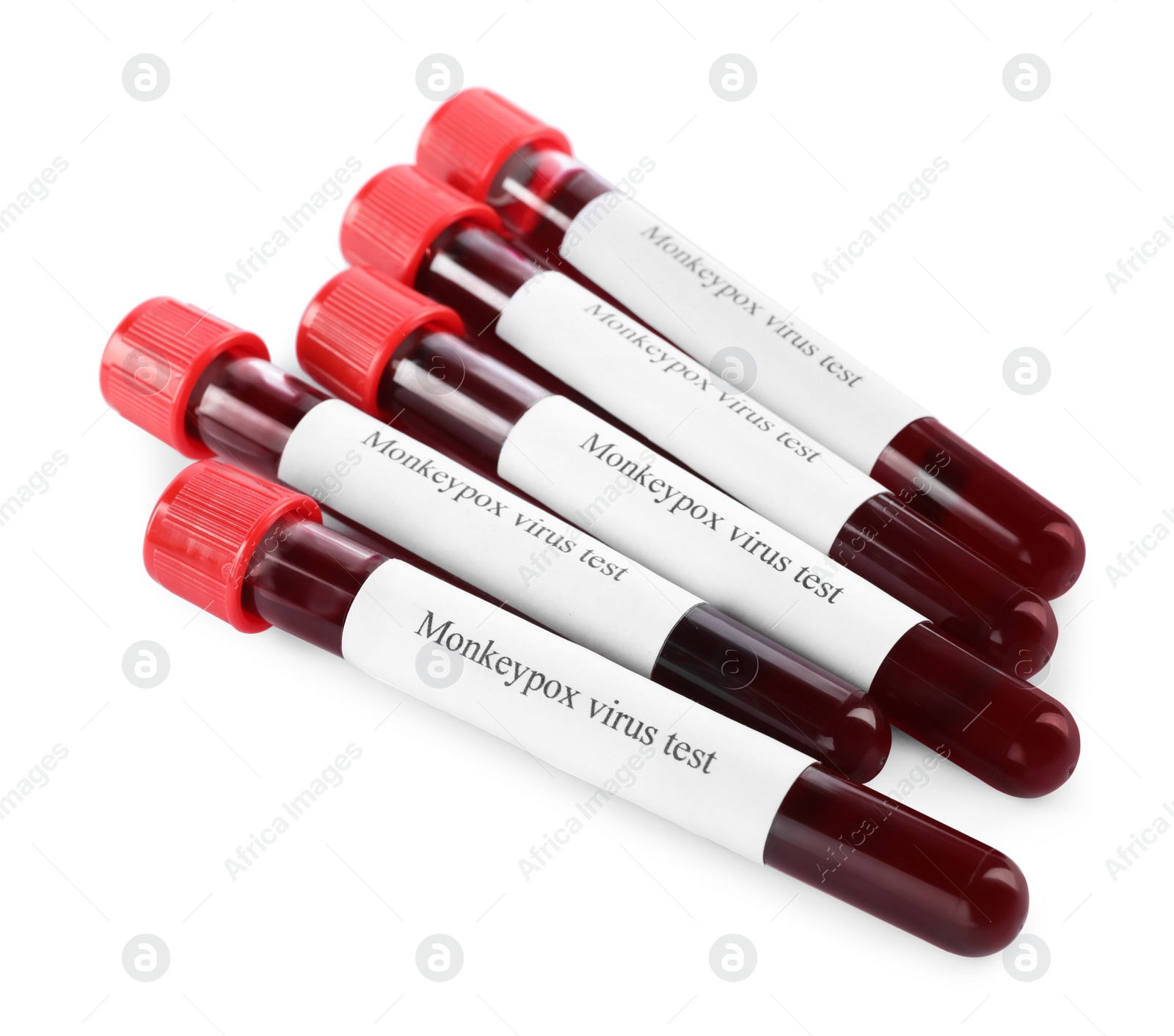 Photo of Monkeypox virus test. Sample tubes with blood on white background