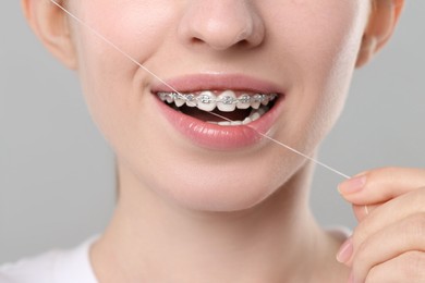 Photo of Smiling woman with braces cleaning teeth using dental floss on grey background, closeup