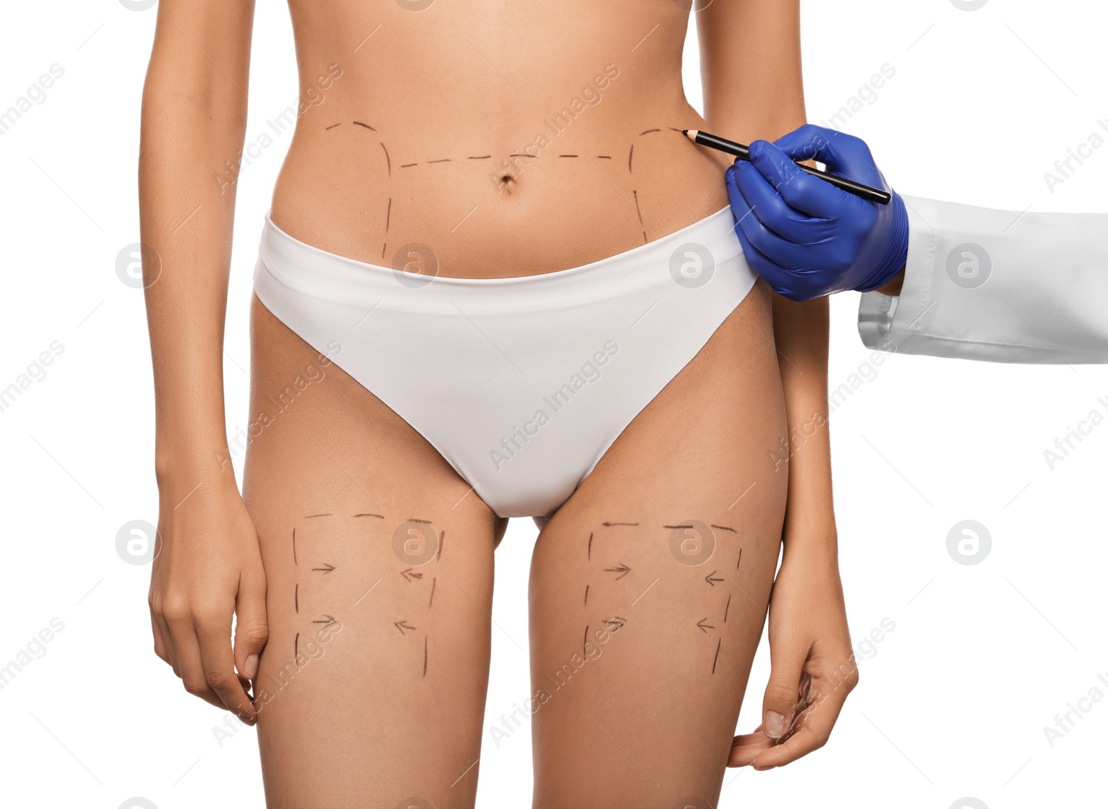 Photo of Doctor with pencil preparing patient for cosmetic surgery operation on white background, closeup