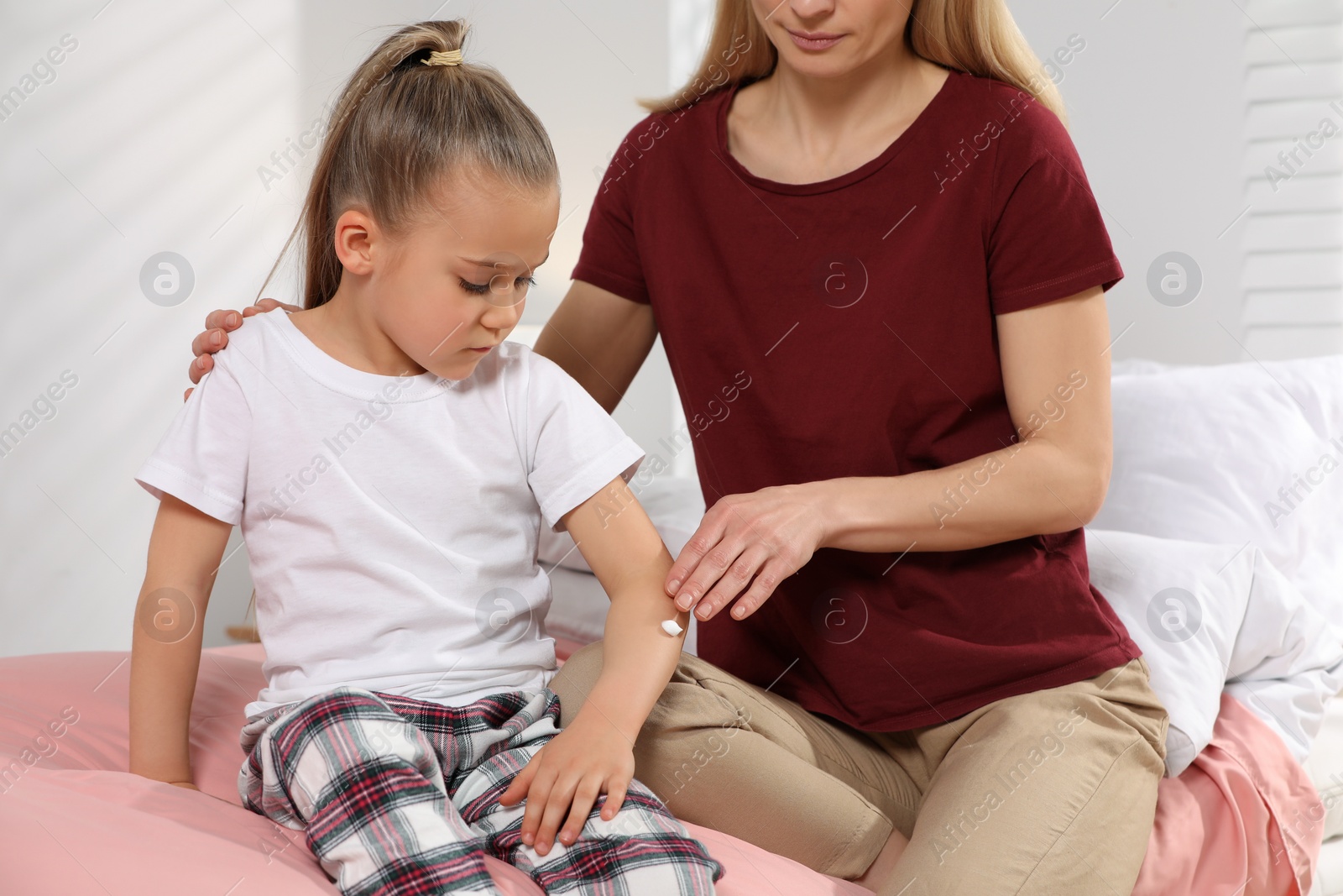 Photo of Mother applying ointment onto her daughter's arm on bed