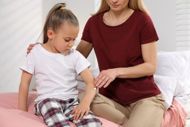 Mother applying ointment onto her daughter's arm on bed