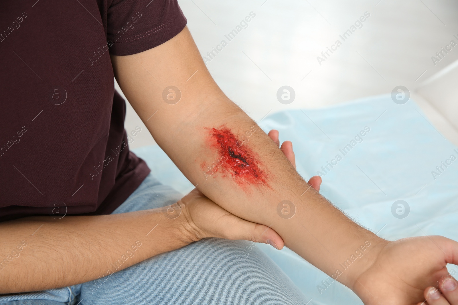 Photo of Young man with injured arm in clinic, closeup. First aid