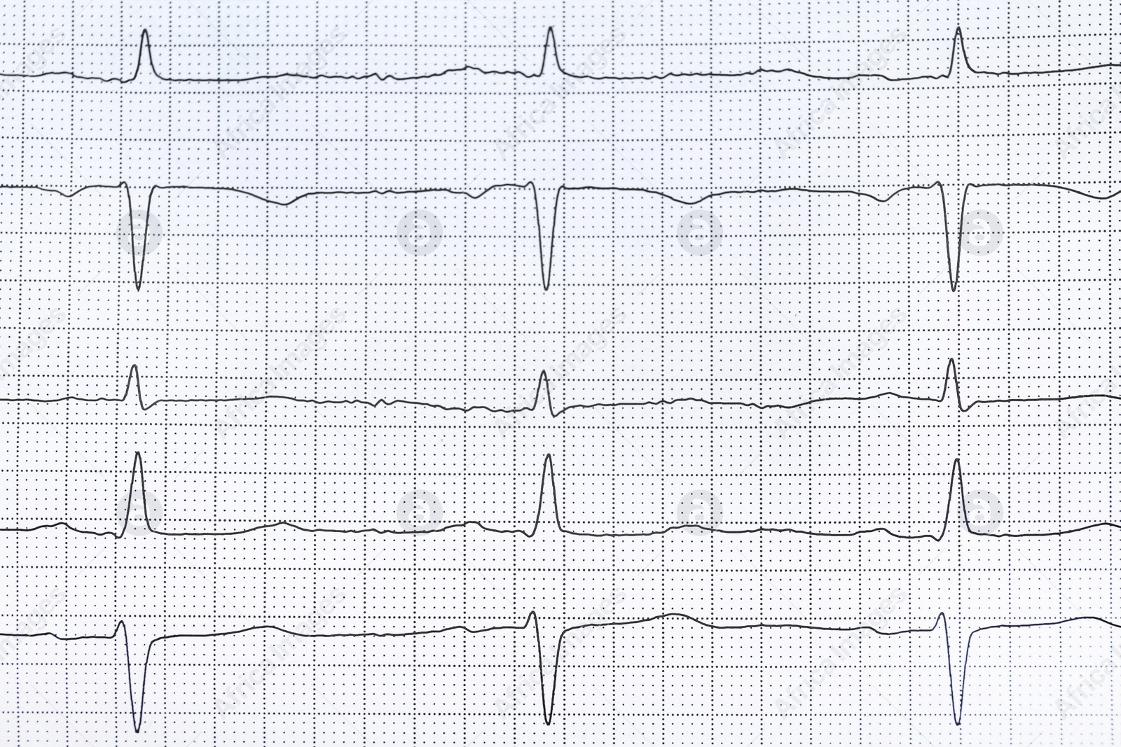 Photo of Cardiogram report as background, top view. Heart diagnosis