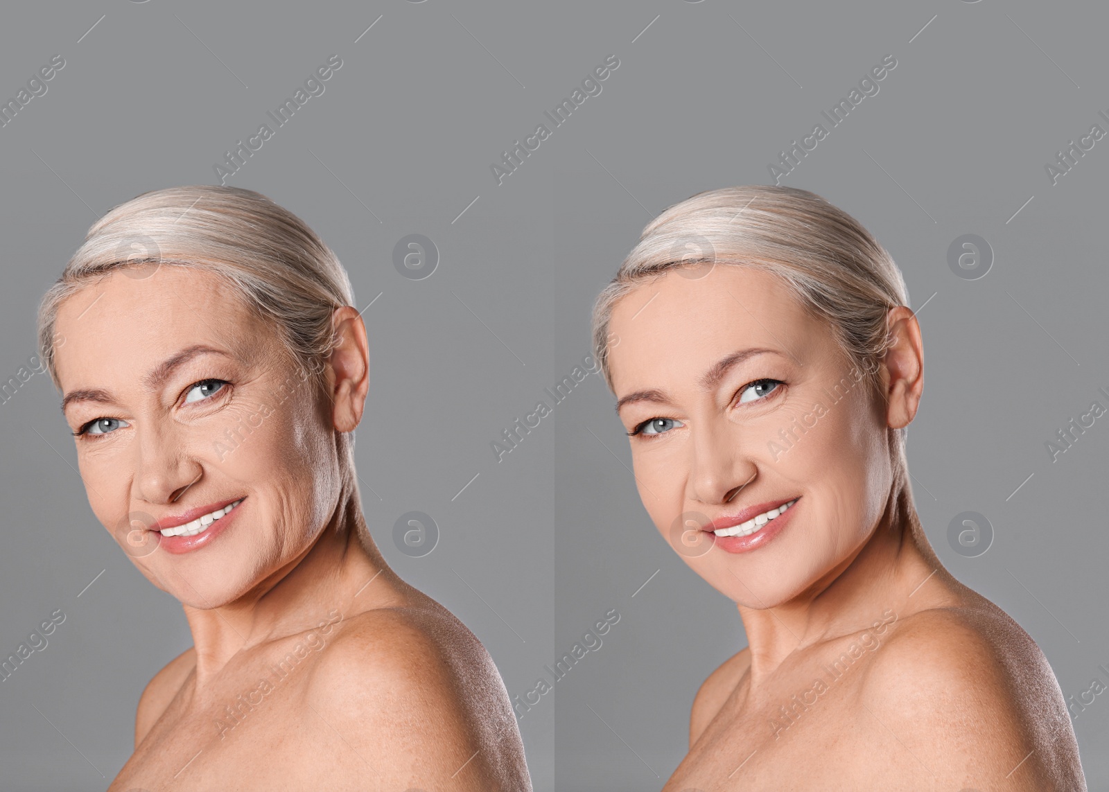 Image of Mature woman before and after cosmetic procedure on grey background 