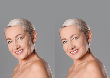 Image of Mature woman before and after cosmetic procedure on grey background 