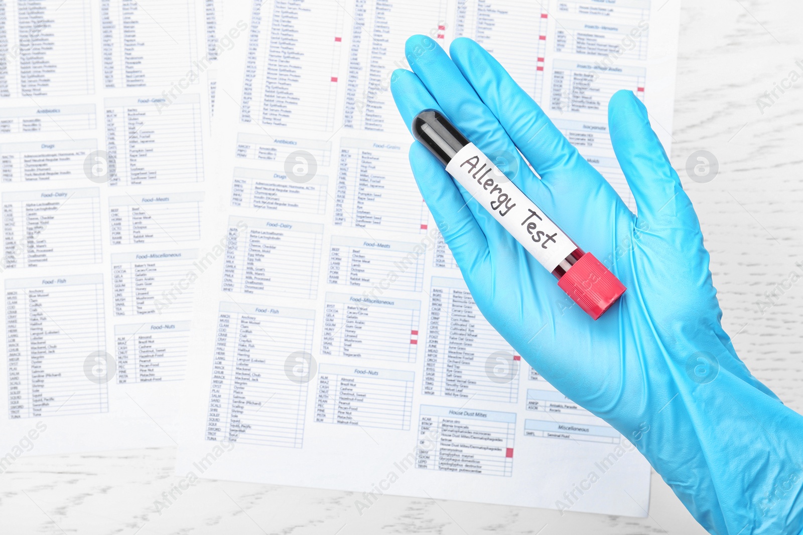 Photo of Doctor holding tube with blood over table, top view. Allergy test