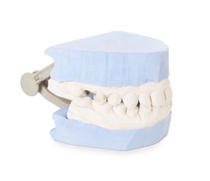 Photo of Dental model with gums isolated on white. Cast of teeth