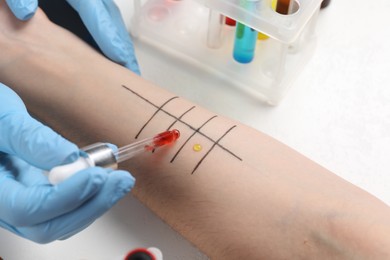 Photo of Doctor doing skin allergy test at light table, closeup
