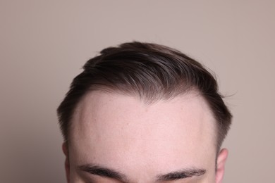 Photo of Baldness concept. Man with receding hairline on beige background, closeup