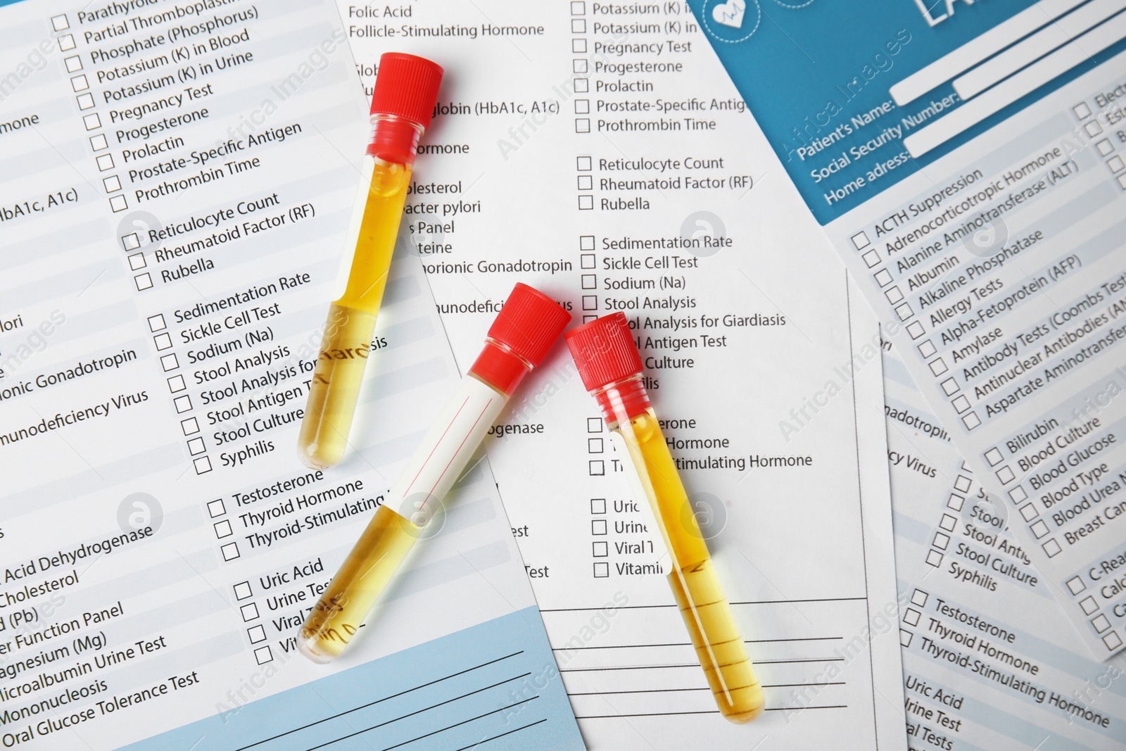 Photo of Test tubes with urine samples for analysis on laboratory test form, flat lay