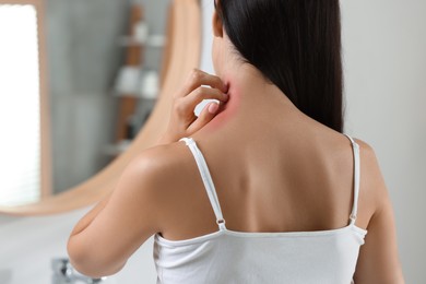 Photo of Suffering from allergy. Young woman scratching her neck indoors, back view