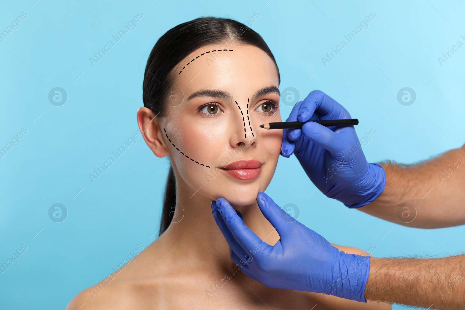 Image of Woman preparing for cosmetic surgery, light blue background. Doctor drawing markings on her face, closeup