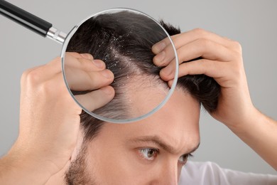 Man suffering from dandruff on grey background, closeup. View through magnifying glass on hair with flakes