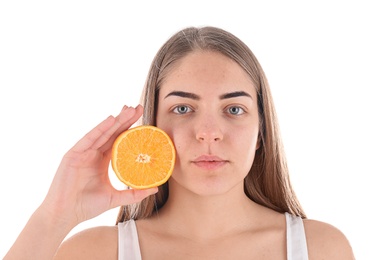 Young woman with acne problem holding orange on white background. Skin allergy