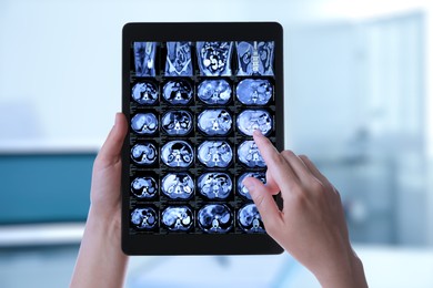 Image of Doctor examining x-ray images on tablet indoors, closeup