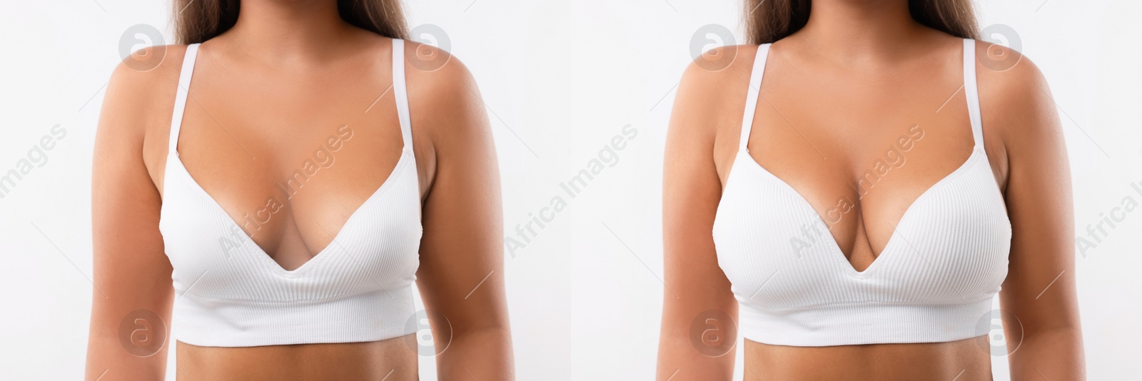 Image of Woman before and after breast augmentation on light background, closeup. Collage with photos showing difference between breast sizes