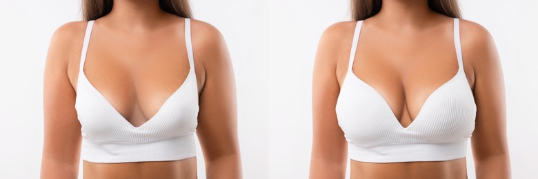 Image of Woman before and after breast augmentation on light background, closeup. Collage with photos showing difference between breast sizes