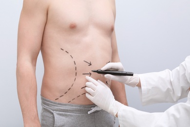 Photo of Doctor drawing lines on man's stomach with marker against light background