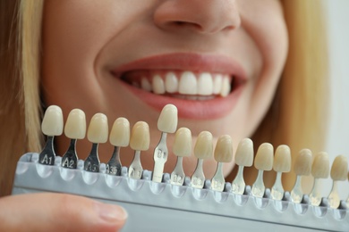 Photo of Woman matching teeth color with palette, closeup. Cosmetic dentistry