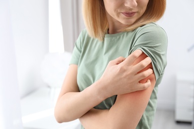 Woman with allergy symptoms scratching arm indoors, closeup. Space for text