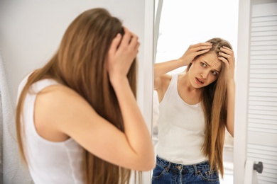 Photo of Young woman with hair loss problem looking in mirror indoors