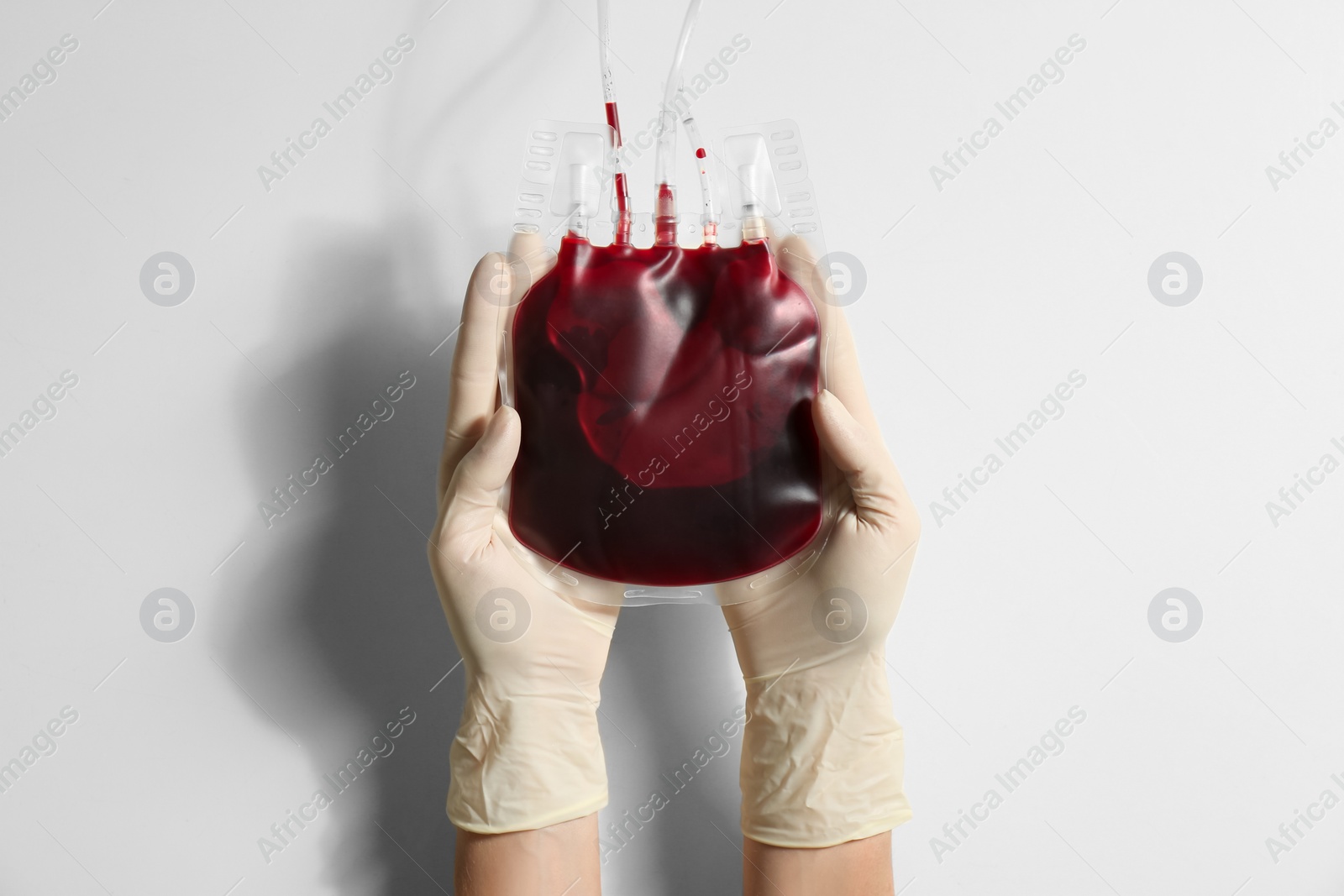 Photo of Woman holding blood for transfusion on light background, closeup. Donation concept