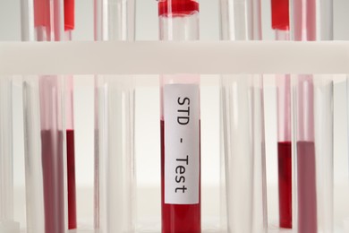 Photo of Tubes with blood samples in rack on white background, closeup. STD test