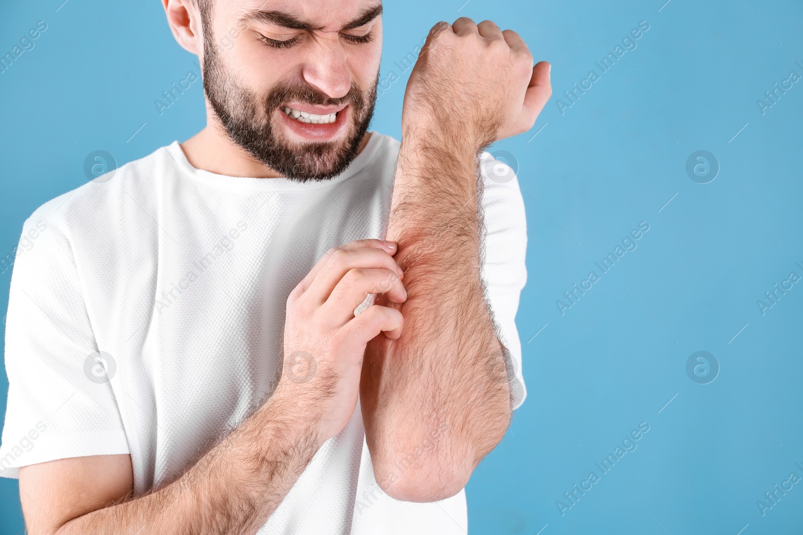 Photo of Young man scratching hand on color background, space for text. Allergies symptoms