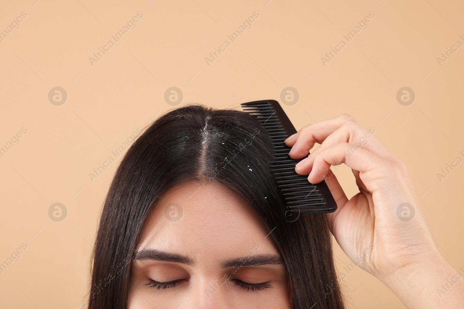 Photo of Woman with comb examining her hair and scalp on beige background, closeup. Dandruff problem