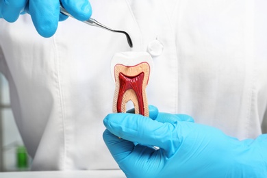 Photo of Dentist holding educational model of tooth and professional tool, closeup