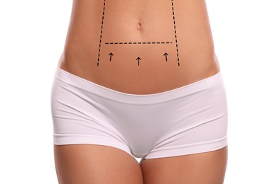 Woman with markings for cosmetic surgery on her abdomen against white background, closeup